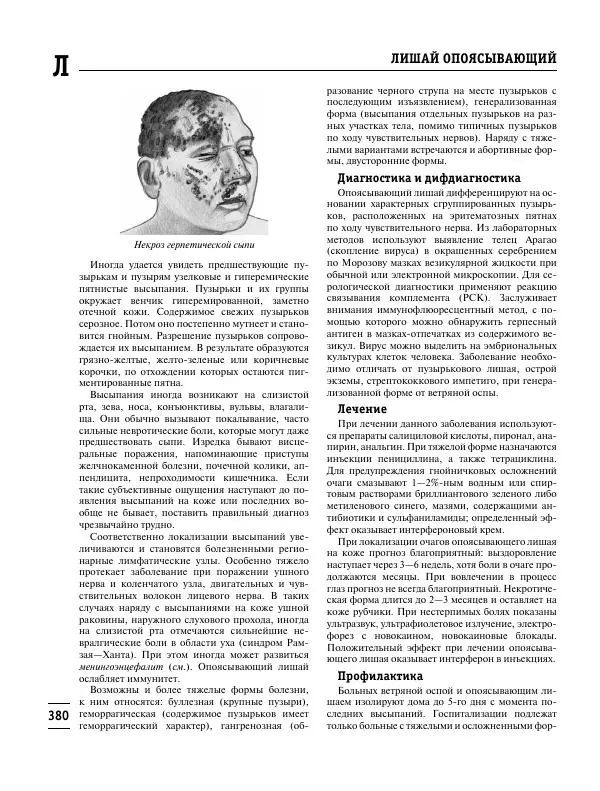 Коллектив авторов Медицина - Популярная медицинская энциклопедия - Страница № 381